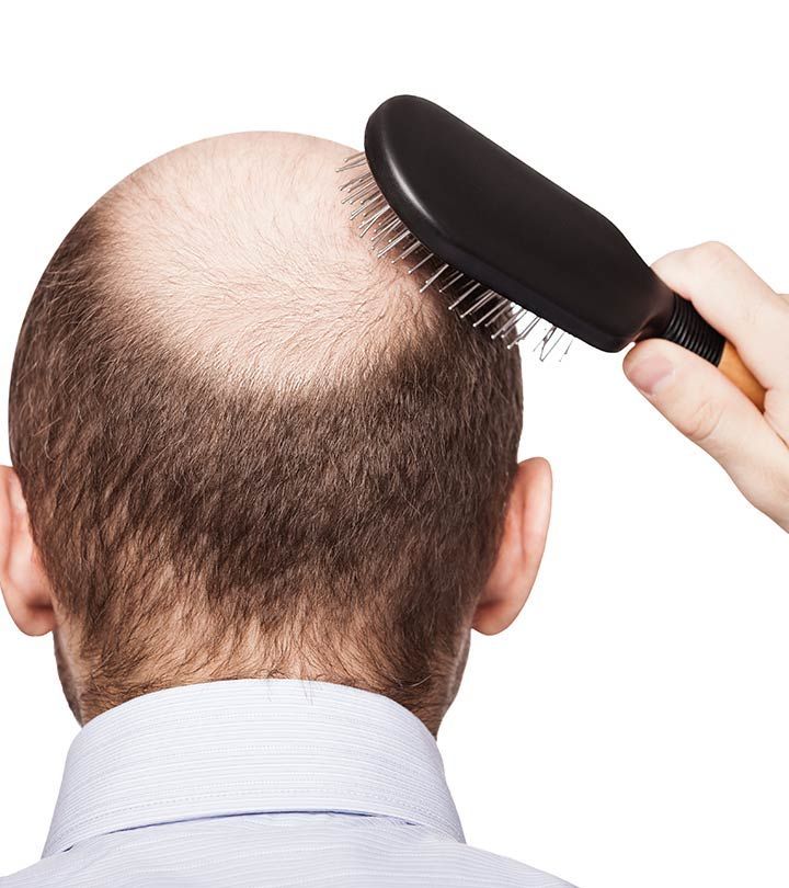 Hair Thinning Treatment Online
