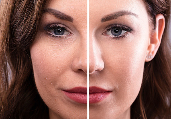 Combat Wrinkles with Everyday Wellness and Preventive Care: Expert Tips from Omnia Telehealth