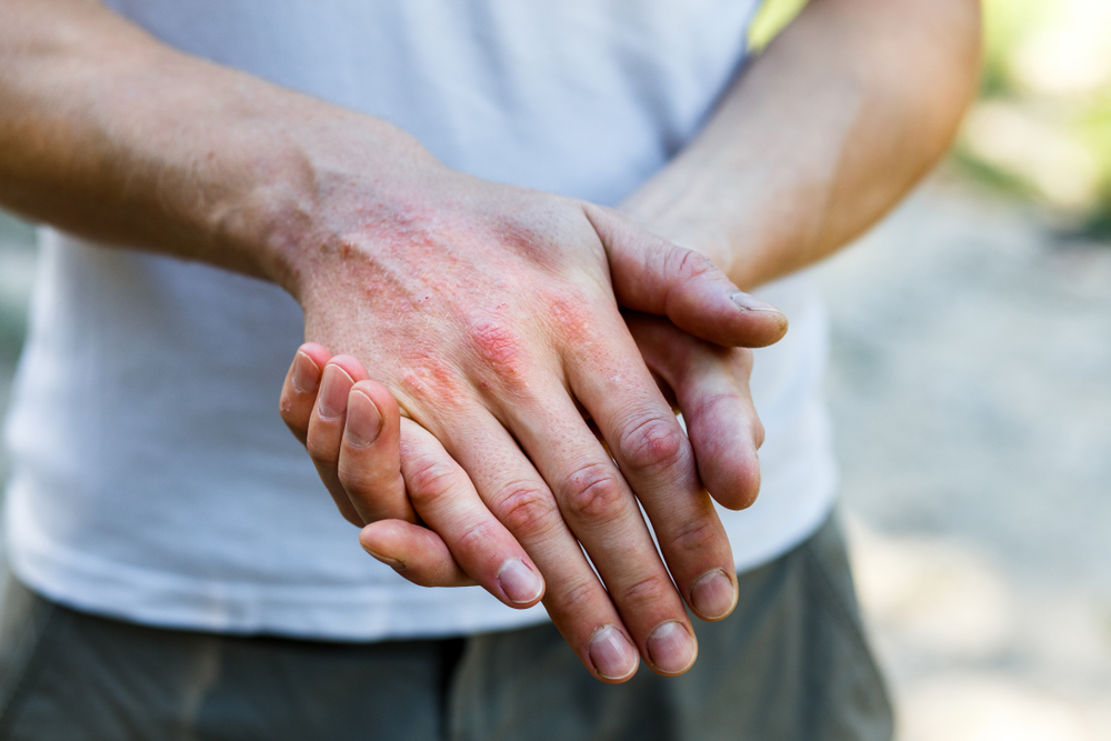 Exploring the Link Between Mental Health and Skin Conditions