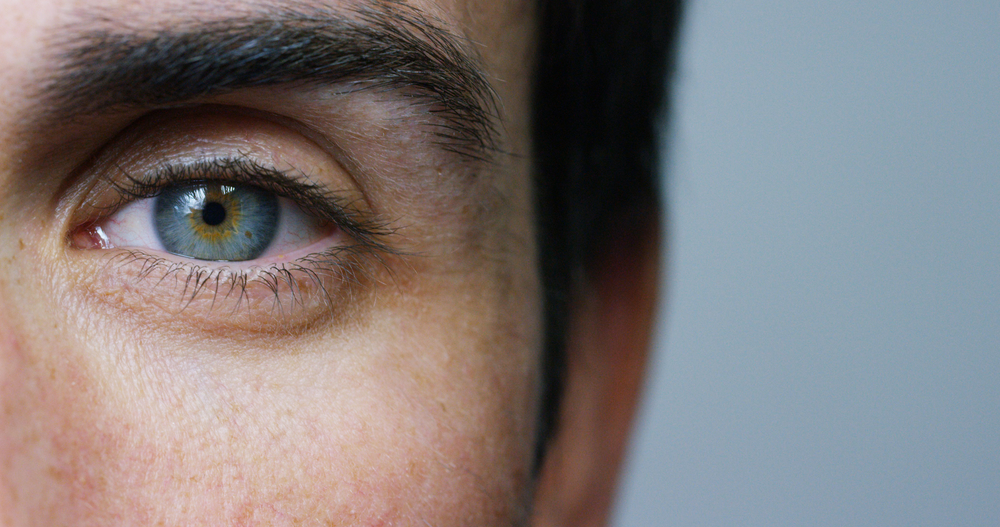 Person with an eyelid stye during a telehealth evaluation