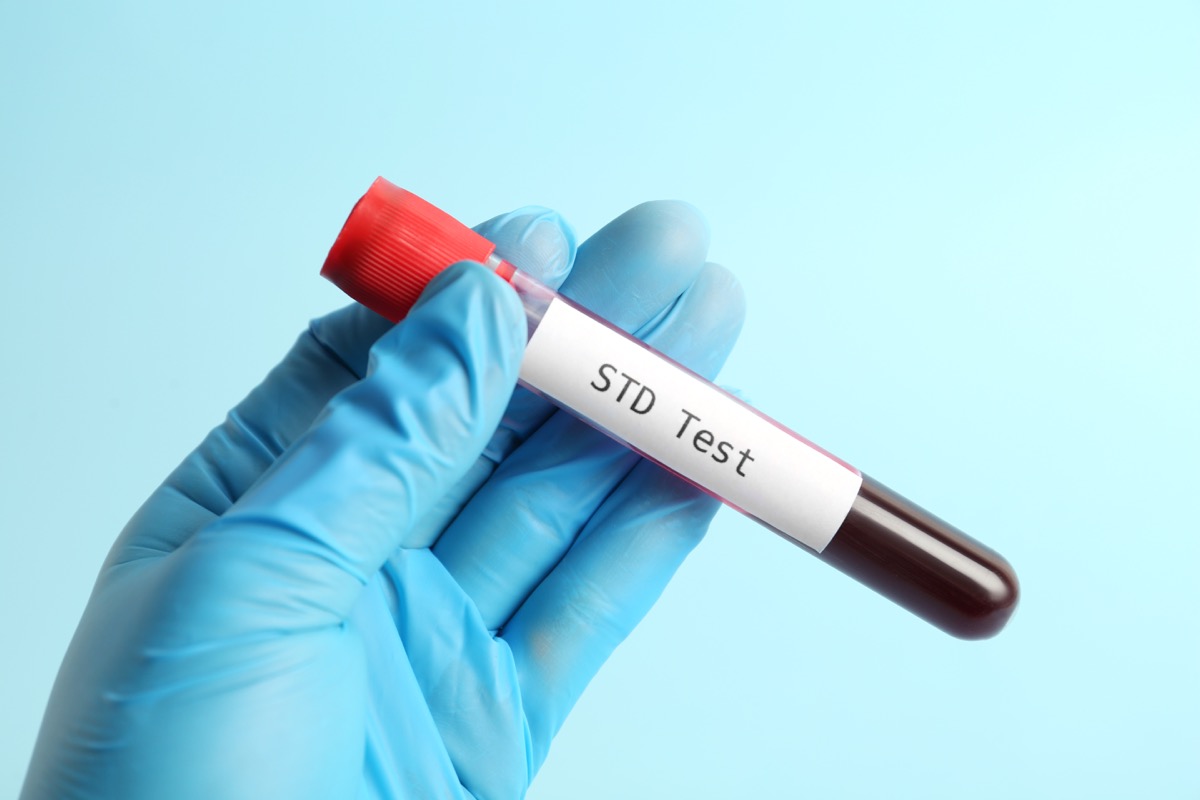 Person seeking confidential care after possible STI exposure via telehealth