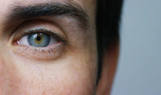 Stye